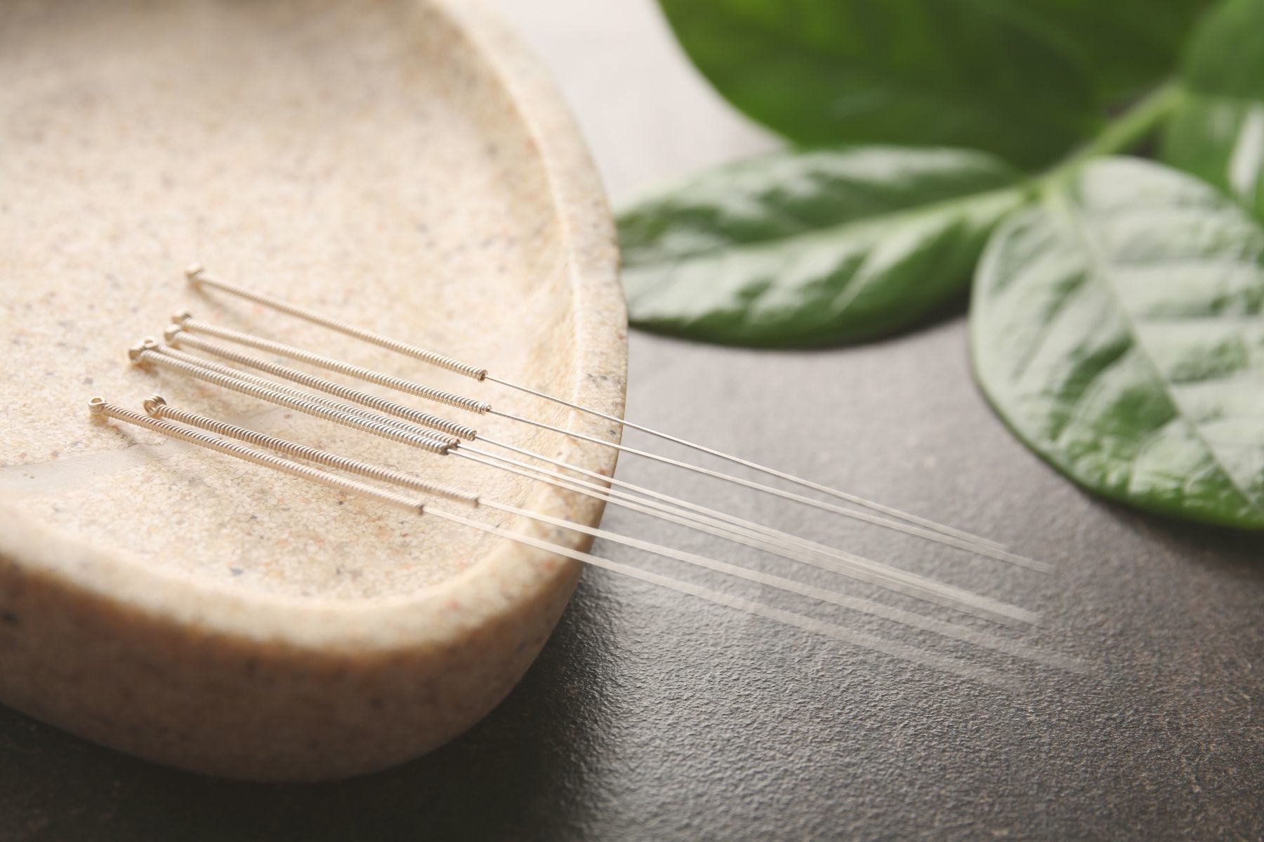 Acupuncture%20ahc%20wellness%20clinic