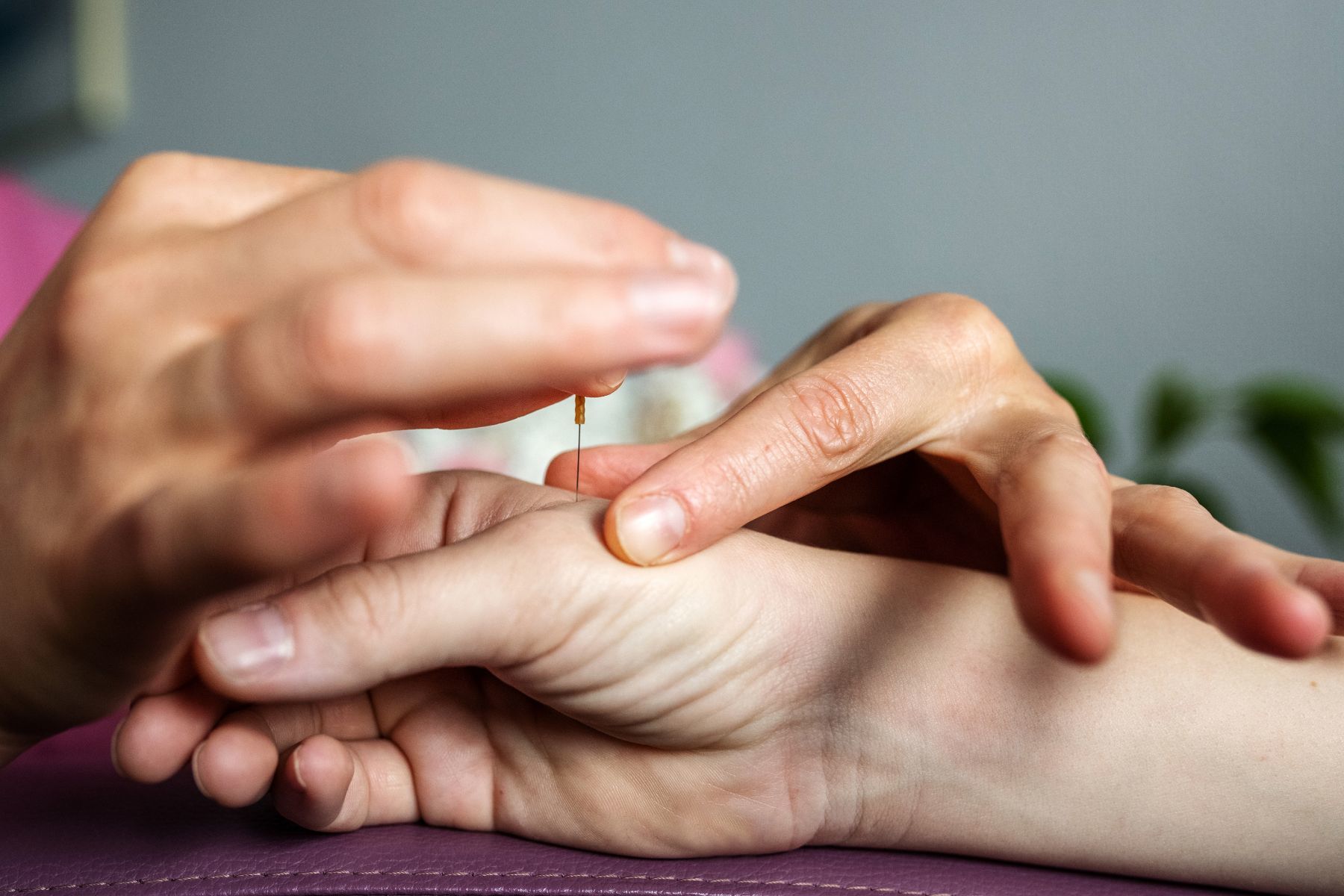 Acupuncture%20for%20sleep%20disorder%20ahc%20wellness%20clinic