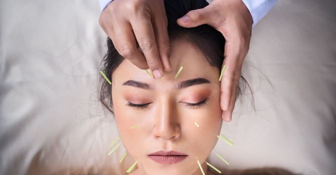 Digestive & Hormonal Balance Acupuncture image