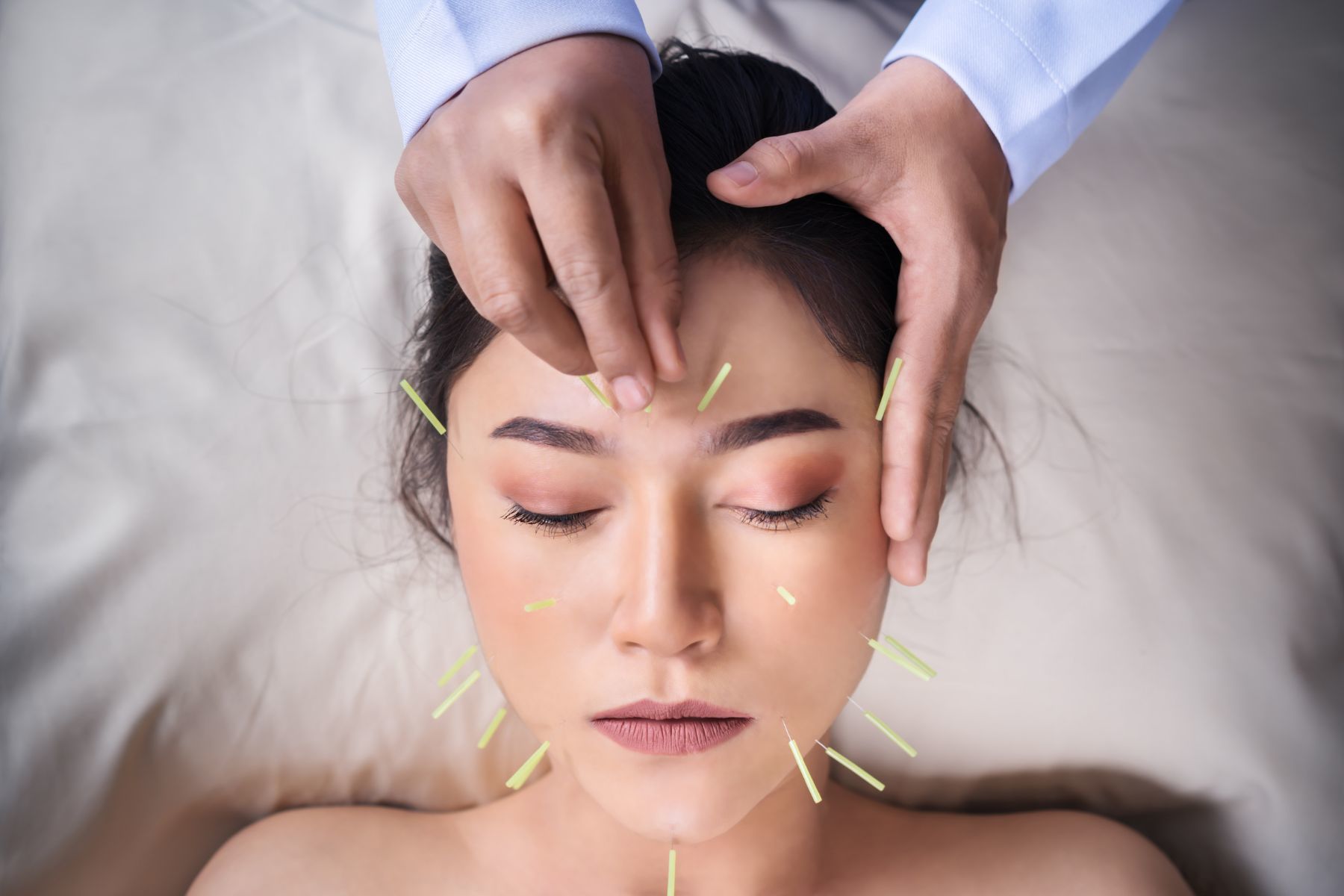 Acupuncture1ahc%20wellness%20clinic