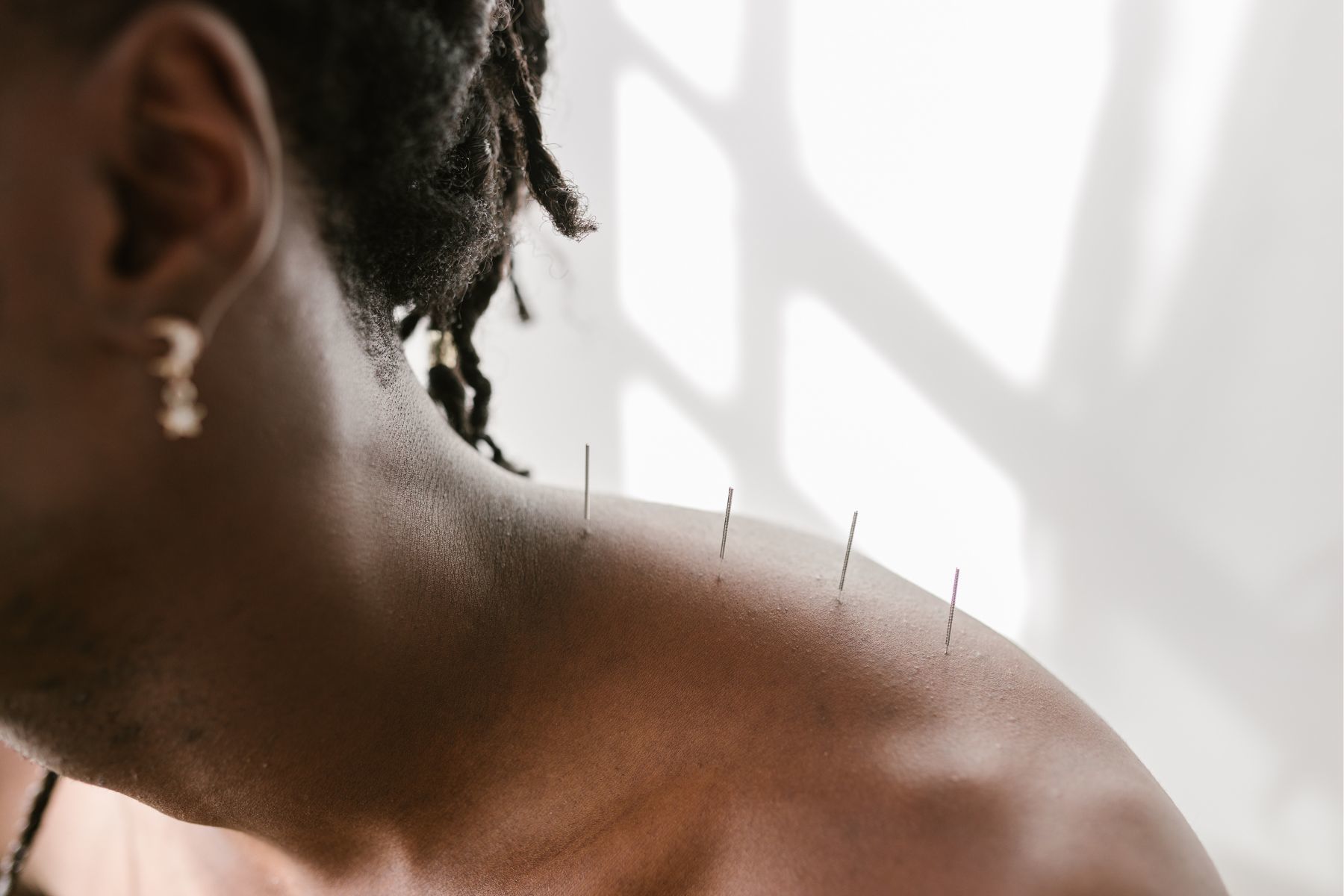 Acupuncture8 weight loss ahc%20wellness%20clinic