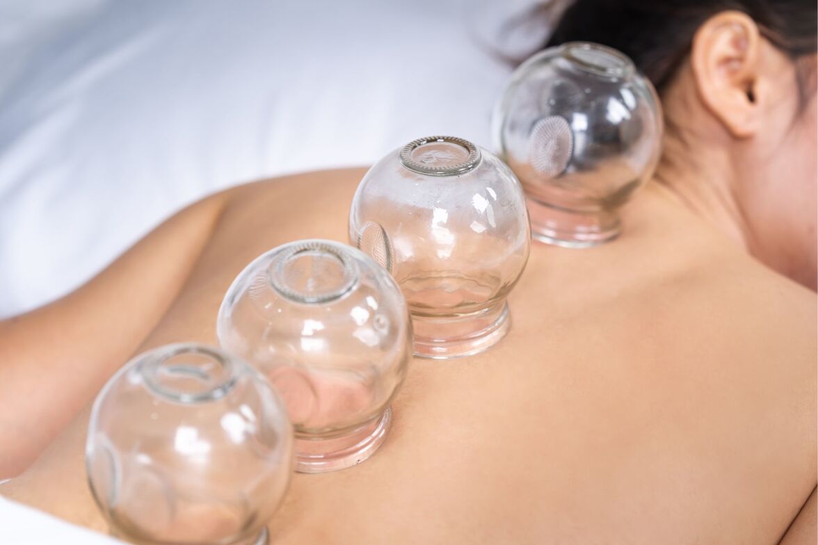 cupping AHC Wellness Clinic