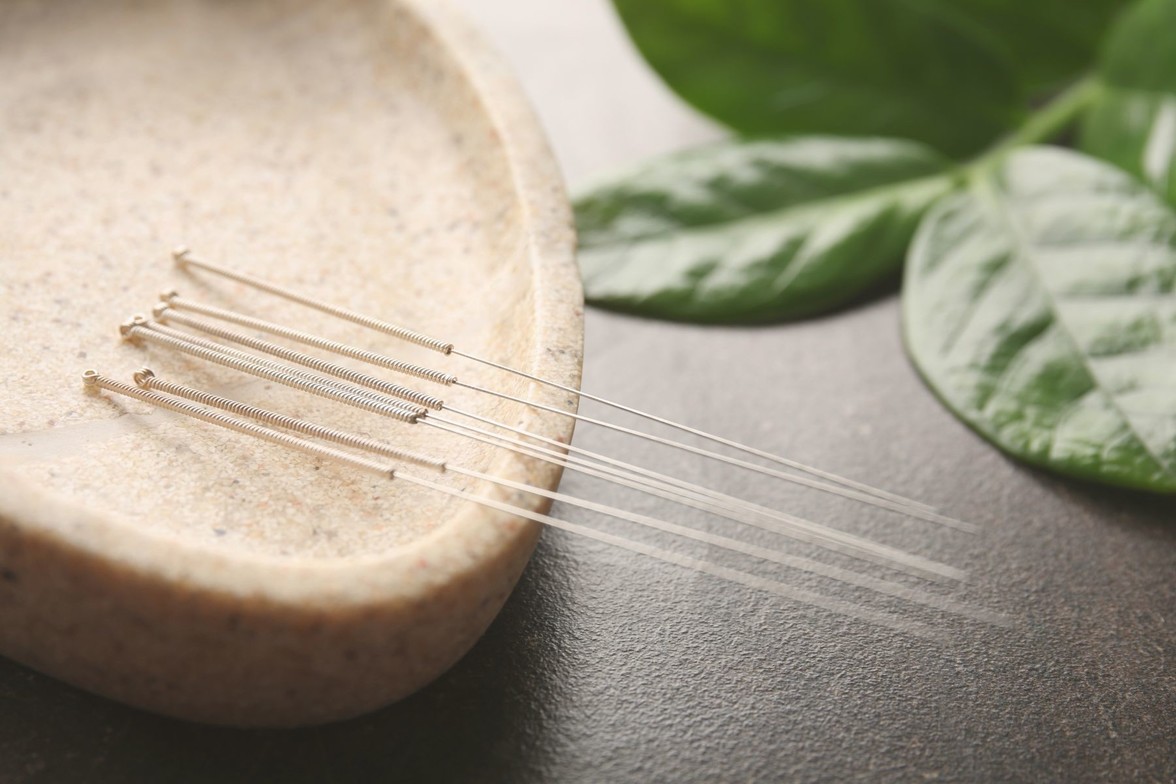 Acupuncture AHC Wellness Clinic Mississauga