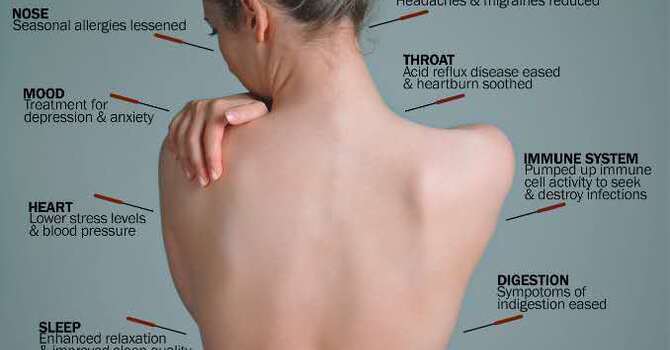 Discover the Power of Traditional Chinese Medicine (TCM) image