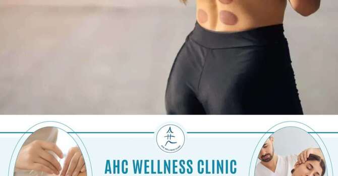 Cupping Massage Benefits for Pain Relief and Recovery